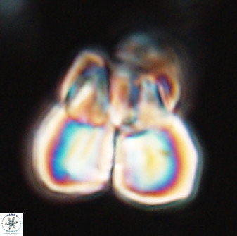 Sphenolithus atlandicus 25904