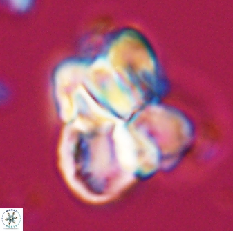 Sphenolithus atlandicus 25905