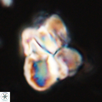 Sphenolithus atlandicus 25906
