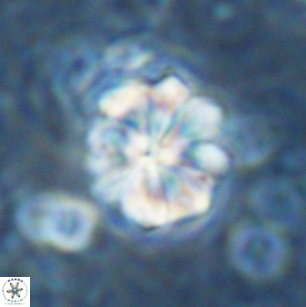 Sphenolithus bouketo 42894