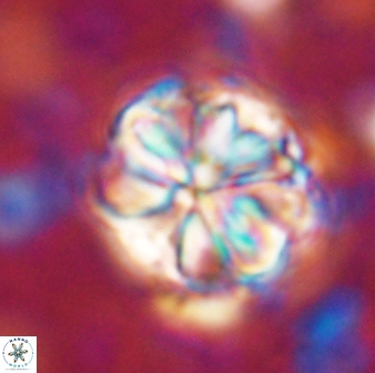 Sphenolithus bouketo 42912