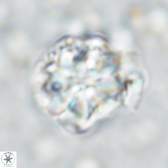 Sphenolithus bouketo 42914