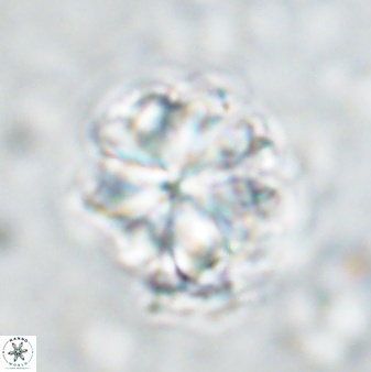 Sphenolithus bouketo 42915