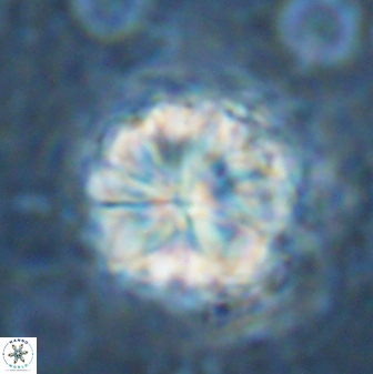 Sphenolithus bouketo 42916