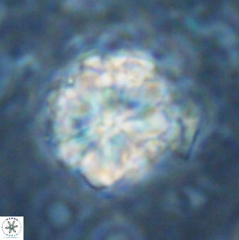 Sphenolithus bouketo 42918