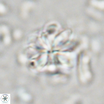 Sphenolithus bouketo 43151
