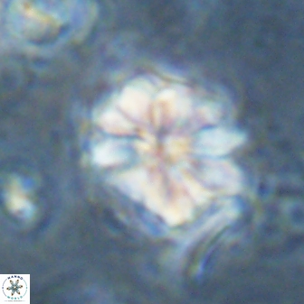 Sphenolithus bouketo 43155