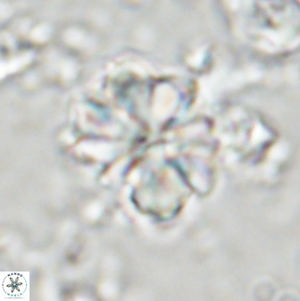 Sphenolithus bouketo 43194
