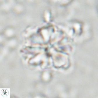 Sphenolithus bouketo 43195