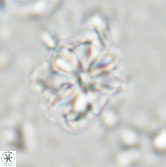 Sphenolithus bouketo 43196