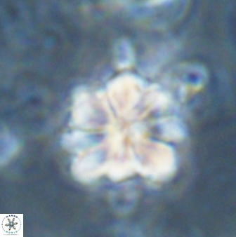 Sphenolithus bouketo 43198