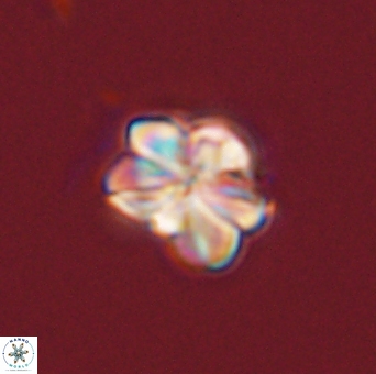 Sphenolithus bouketo 43992