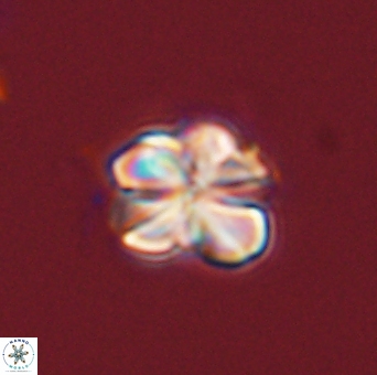 Sphenolithus bouketo 43993