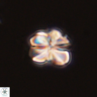 Sphenolithus bouketo 43994
