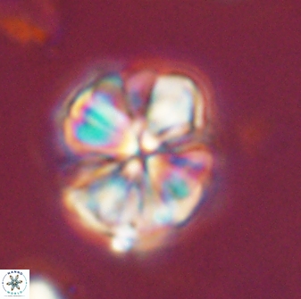 Sphenolithus bouketo 44201