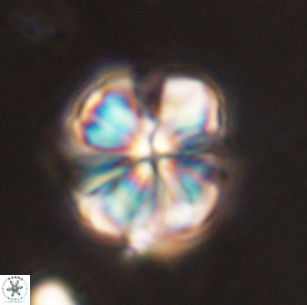 Sphenolithus bouketo 44202