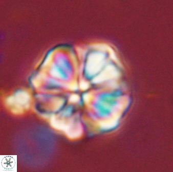 Sphenolithus bouketo 44205