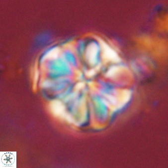 Sphenolithus bouketo 44213