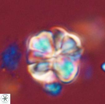 Sphenolithus bouketo 44214