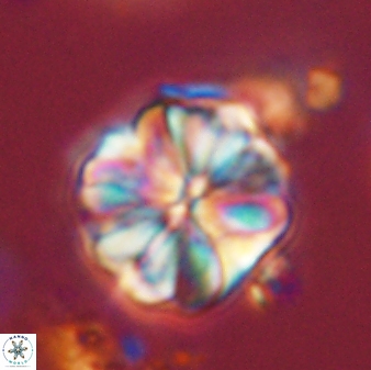 Sphenolithus bouketo 44218