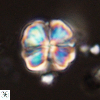 Sphenolithus bouketo 44220