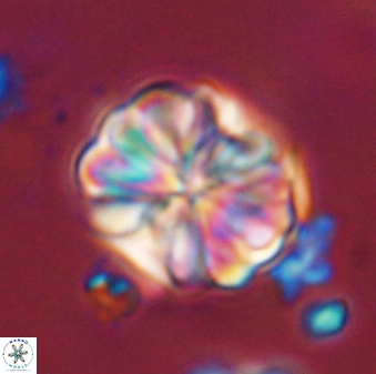 Sphenolithus bouketo 44225