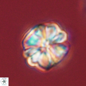 Sphenolithus bouketo 45177