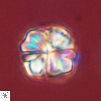 Sphenolithus bouketo 45178