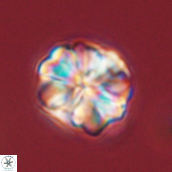 Sphenolithus bouketo 45181