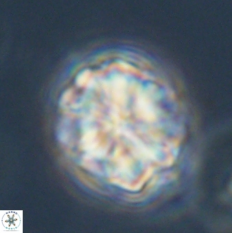 Sphenolithus bouketo 45183