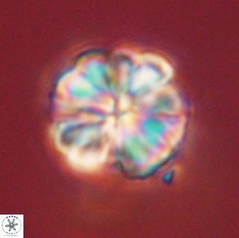 Sphenolithus bouketo 45187