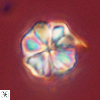 Sphenolithus bouketo 45191