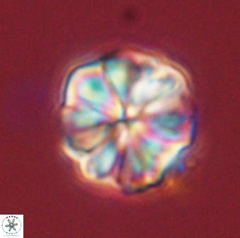 Sphenolithus bouketo 45195