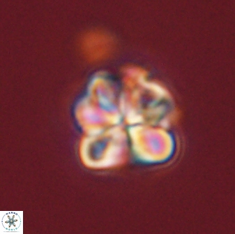 Sphenolithus bouketo 45810