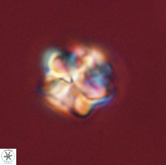 Sphenolithus bouketo 45814