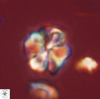 Sphenolithus bouketo 45816