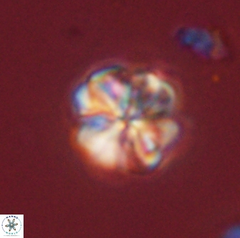 Sphenolithus bouketo 45817