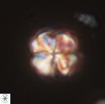 Sphenolithus bouketo 45818