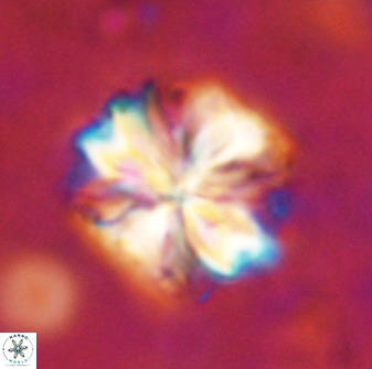 Sphenolithus bouketo 50156