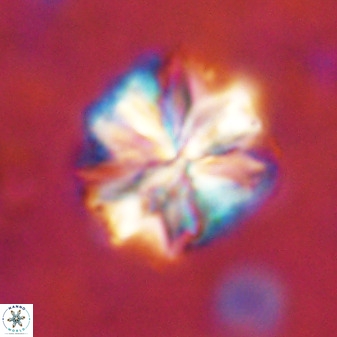 Sphenolithus bouketo 50159