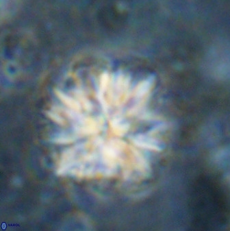 Sphenolithus bouketo 50161