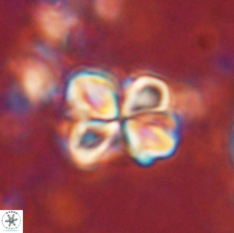 Sphenolithus bouketo 60303