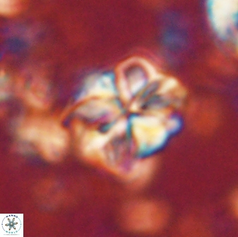 Sphenolithus bouketo 60306