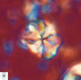 Sphenolithus bouketo 60309