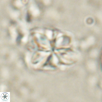 Sphenolithus bouketo 60311