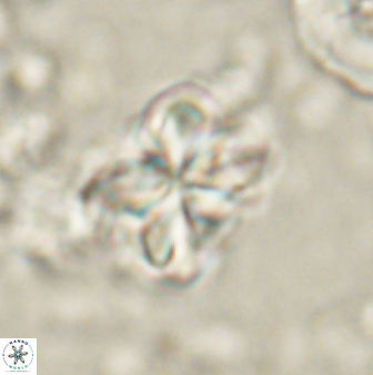 Sphenolithus bouketo 60312