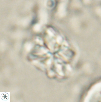 Sphenolithus bouketo 60313