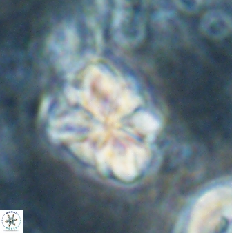 Sphenolithus bouketo 60314