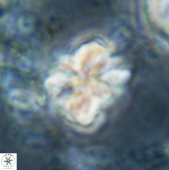 Sphenolithus bouketo 60316