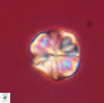 Sphenolithus bouketo 60448